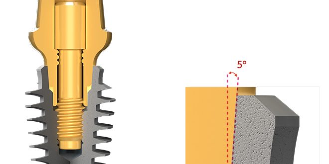 اباتمنت مستقیم