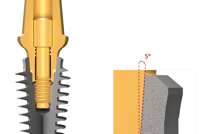 اباتمنت مستقیم