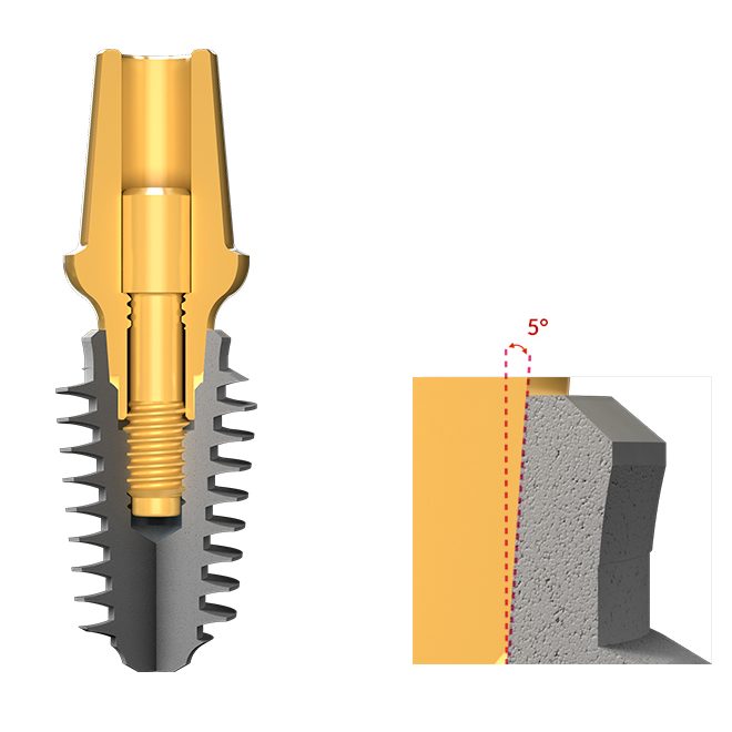 اباتمنت مستقیم