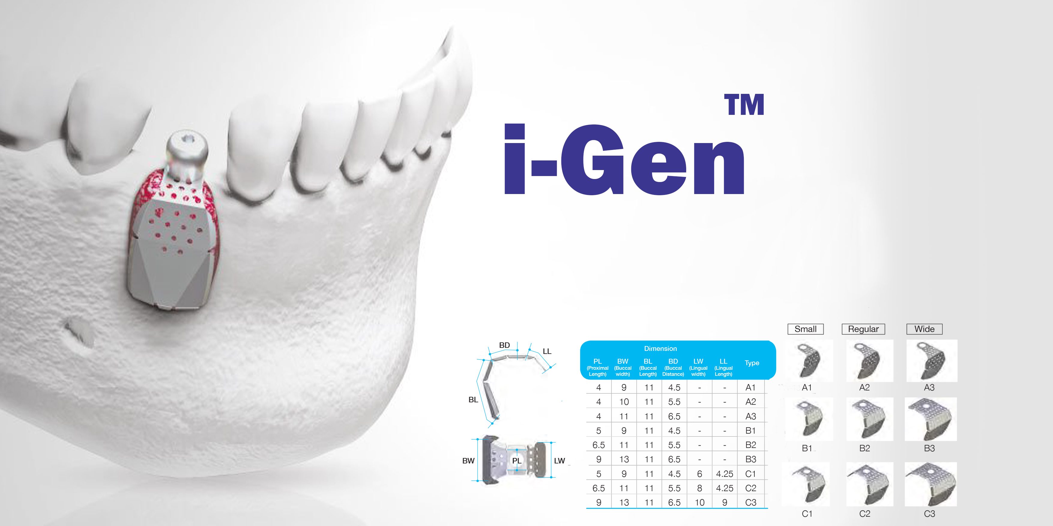 مش های ترمیم ریج (Igen)