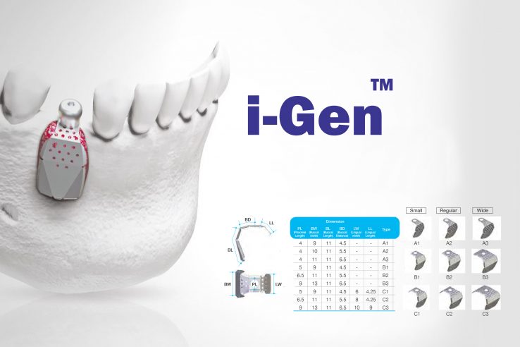 مش های ترمیم ریج (Igen)