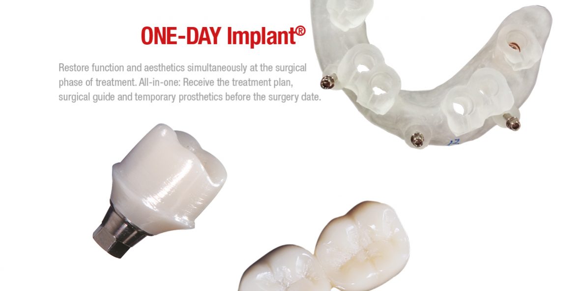 one day implant service