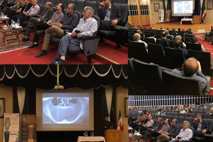 شایع ترین علل شکست درمان ایمپلنت، برای جلوگیری از آن چه کینم؟