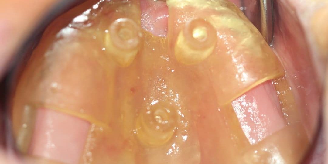 WhatsApp Image 2020-04-07 at 16.08.39 (2)